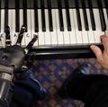 Thought-controlled bionic arm