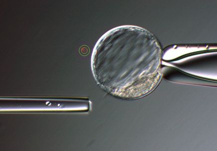 Genome editing