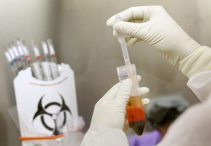 Drugs considered for COVID-19 can raise risk for dangerous abnormal heart rhythms