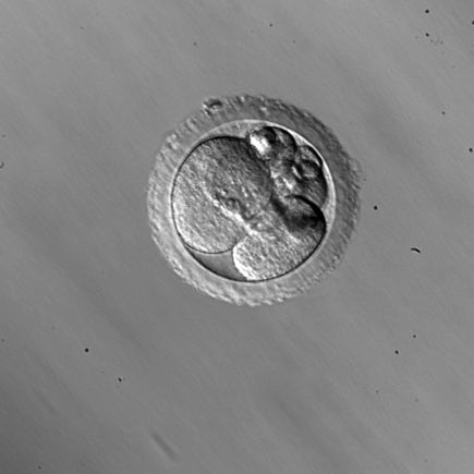 Rhesus embryo cellular fragmentation