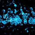 Parkinson's research