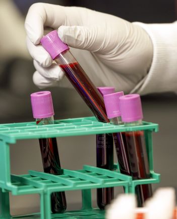 Blood samples