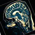 Brain imaging