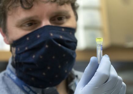 COVID-19 antibody testing