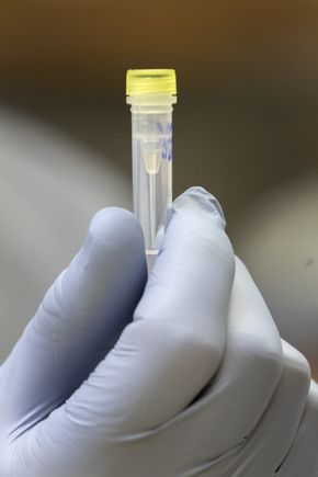 COVID-19 antibody testing