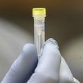COVID-19 antibody testing