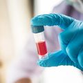 Coronavirus survivors could be protected against future illness, study suggests