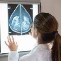 Understanding the aggressive breast cancers missed by mammogram screening