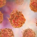 Prostate cancer cells