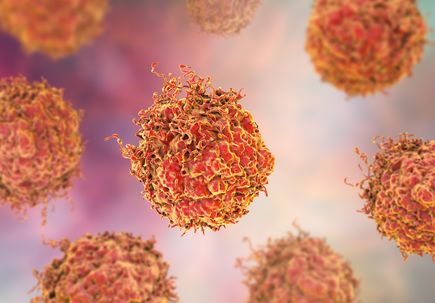 Prostate cancer cells