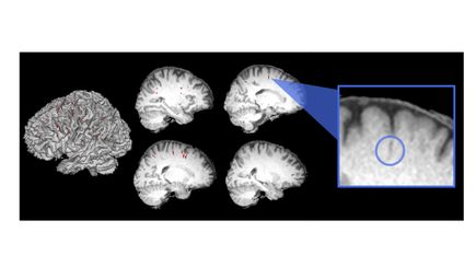 Astronaut Brain Fig.  1