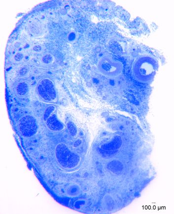Magnified clitoris nerve tissue