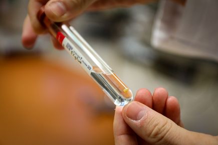 Clitoris nerve tissue sample