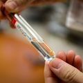 Clitoris nerve tissue sample
