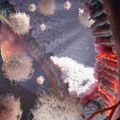 Lipid nanoparticle-based gene therapy