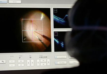 Gene therapy