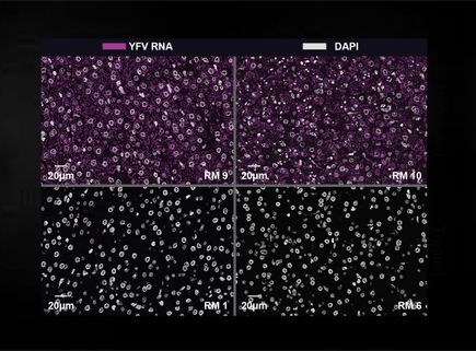Monoclonal Antibodies to Fight Yellow Fever