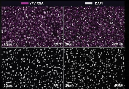 Monoclonal Antibodies to Fight Yellow Fever