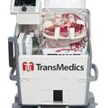 Perfusion pump for liver transplantation