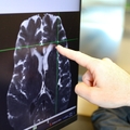 Researching brain cleaning