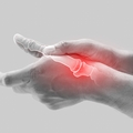 Studies reveal how shingles vaccine should be used in arthritis patients