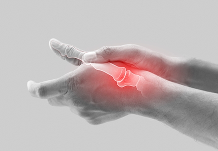 arthritis