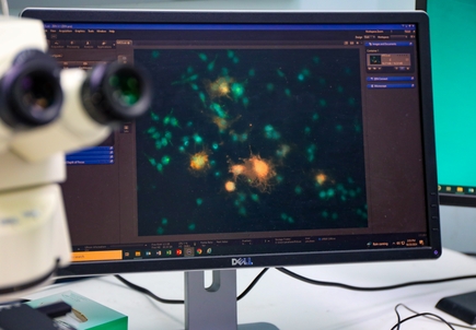 Natural compound found in flowers halts progression of MS, some cancers