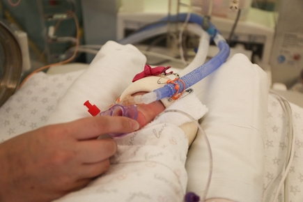 NICU CPAP