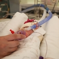 NICU CPAP