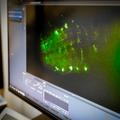 Una célula cerebral a menudo pasada por alto podría ayudar a prevenir enfermedades y desarrollar tratamientos