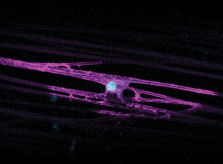 Researchers identify gene implicated in disorders affecting millions
