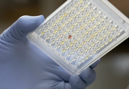 Study suggests long COVID is more prevalent than previously thought