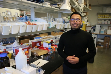 Un proyecto busca desarrollar un método de detección de Alzheimer mediante prueba de la retina.