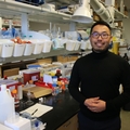 Project seeks to develop retinal screening for Alzheimer’s