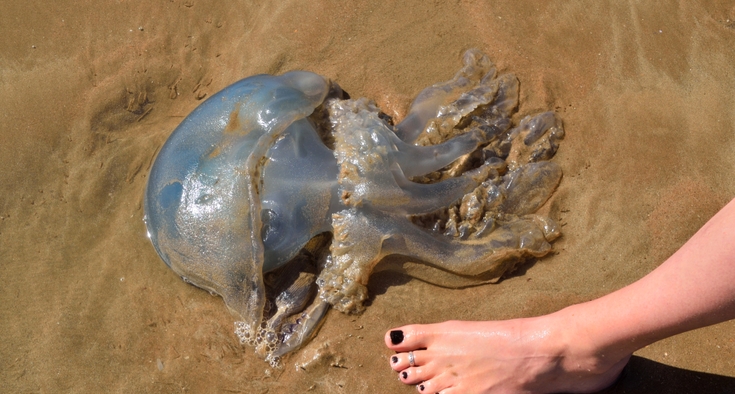 Urine for a jellyfish sting? There are far better remedies.