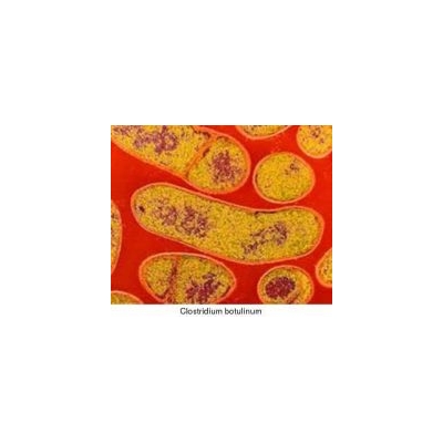Nose-Spray Vaccine Against Botulism Effective in Early Tests