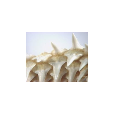 Scientists Discover Why Teeth Form in a Single Row