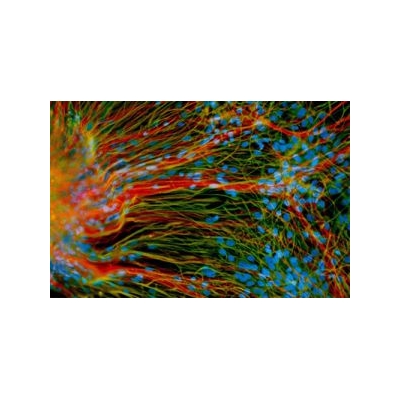 URMC Scientists Awarded $6.8 Million in Stem Cell Research Grants