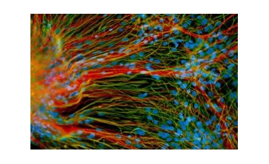 URMC Scientists Awarded $6.8 Million in Stem Cell Research Grants