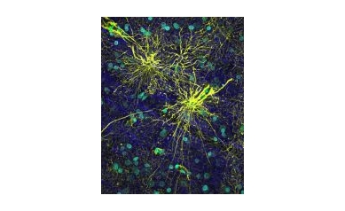 Astrocytes Help Separate Man from Mouse