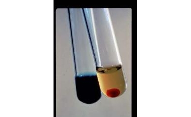 Blood Test for Brain Injuries Gains Momentum