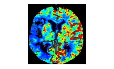 CT%20Perfusion