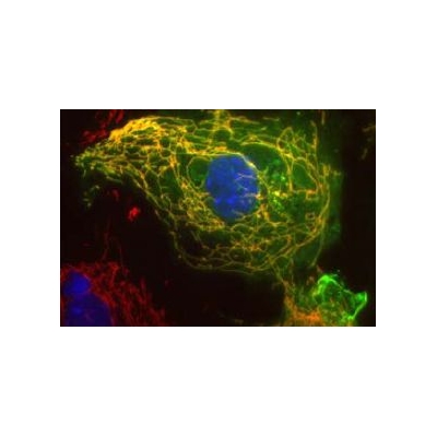 Protein Regulates Movement of Mitochondria in Brain Cells