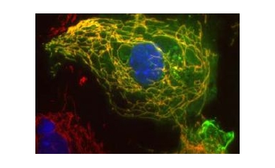 Protein Regulates Movement of Mitochondria in Brain Cells