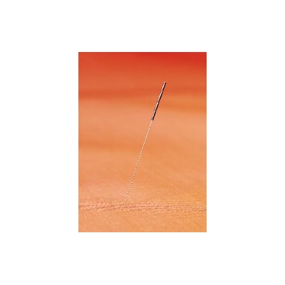 Acupuncture and Fertility Topic of Free Seminar