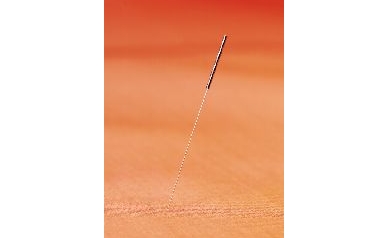 Acupuncture and Fertility Topic of Free Seminar