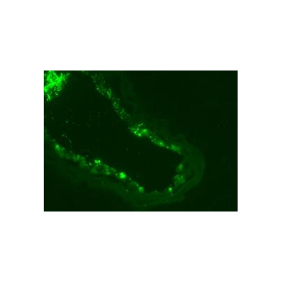 Study in Nature: MicroRNAs Hold Promise For Treating Diseases in Blood Vessels