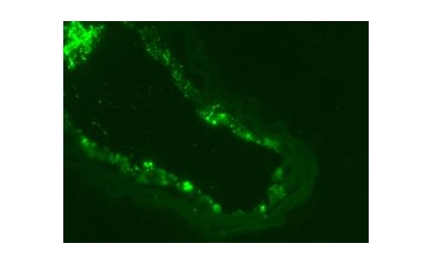 Study in Nature: MicroRNAs Hold Promise For Treating Diseases in Blood Vessels