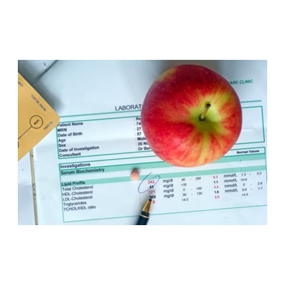 Do Your Numbers Count? New Guidelines for Cholesterol Meds