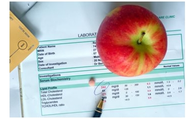 Do Your Numbers Count? New Guidelines for Cholesterol Meds